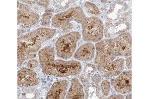 ABIN6266785 at 1/100 staining human kidney tissue sections by IHC-P.