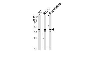 Rat Csnk2a1 Antibody (N-term) (ABIN1881717 and ABIN2843635) western blot analysis in 293 cell line , rat brain and cerebellum tissue lysates (35 μg/lane). (CSNK2A1/CK II alpha antibody  (N-Term))