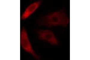 ABIN6274618 staining COLO205 cells by IF/ICC. (CDKAL1 antibody  (N-Term))