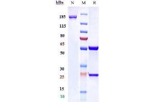 Anti-TrkA / NTRK1 Reference Antibody (GBR 900) on SDS-PAGE under reducing (R) condition.