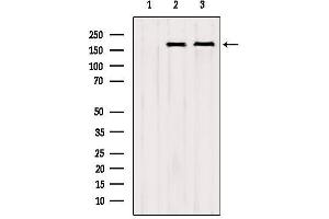 Western blot analysis of extracts from various samples, using CNOT1 Antibody.
