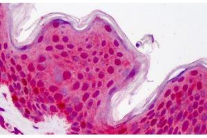 Human Skin: Formalin-Fixed, Paraffin-Embedded (FFPE) (YWHAB antibody  (AA 34-221))