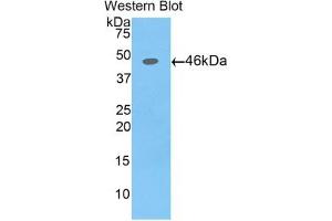 Detection of Recombinant AFP,Pig using Polyclonal Antibody to Alpha-Fetoprotein (AFP) (alpha Fetoprotein antibody  (AA 46-210))