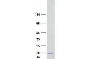 CARD18 Protein (Myc-DYKDDDDK Tag)