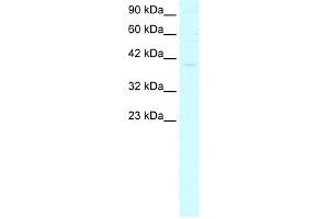 WB Suggested Anti-GTF2B Antibody Titration:  4. (GTF2B antibody  (N-Term))