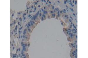 Used in DAB staining on fromalin fixed paraffin- embedded Kidney tissue (CD101 antibody  (AA 302-531))