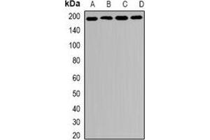 Western blot analysis of MRP1 expression in HT29 (A), SKOV3 (B), mouse spleen (C), mouse lung (D) whole cell lysates. (MRP1 antibody)