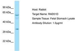 Image no. 1 for anti-RAD51 Homolog D (RAD51D) (AA 259-308) antibody (ABIN6749950) (RAD51D antibody  (AA 259-308))