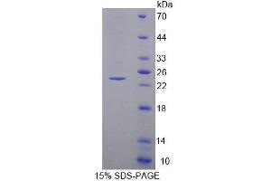 SDS-PAGE (SDS) image for Acyl-CoA Dehydrogenase, C-2 To C-3 Short Chain (Acads) (AA 210-396) protein (His tag) (ABIN6239321) (ACADS Protein (AA 210-396) (His tag))