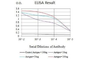 Black line: Control Antigen (100 ng),Purple line: Antigen (10 ng), Blue line: Antigen (50 ng), Red line:Antigen (100 ng) (TUBB3 antibody)