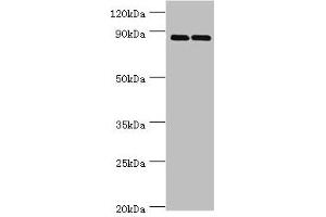 Western blot All lanes: SET and MYND domain-containing protein 4 antibody at 4 μg/mL Lane 1: HepG2 whole cell lysate Lane 2: Hela whole cell lysate Secondary Goat polyclonal to rabbit IgG at 1/10000 dilution Predicted band size: 89 kDa Observed band size: 89 kDa (SMYD4 antibody  (AA 1-260))