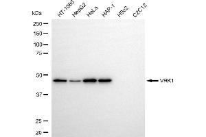 Western blotting analysis using VRK1 antibody (ABIN7800811).