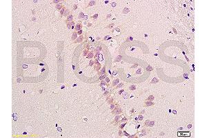 Formalin-fixed and paraffin embedded rat brain tissue labeled with Anti-beta-Amyloid 1-40 (CT) Polyclonal Antibody, Unconjugated (ABIN729328) at 1:200, followed by conjugation to the secondary antibody and DAB staining (Abeta 1-40 antibody  (C-Term))