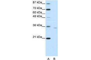 WB Suggested Anti-OTP Antibody Titration:  0. (OTP antibody  (C-Term))