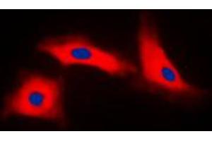 Immunofluorescent analysis of APAF-1 staining in HeLa cells.