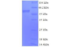 Cytochrome C1 Protein (CYC1) (AA 85-325, full length) (GST tag)