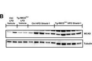 MCD induction suppresses the fatty acid oxidative pathway. (Medium-Chain Specific Acyl-CoA Dehydrogenase, Mitochondrial (MCAD) (Center) antibody)