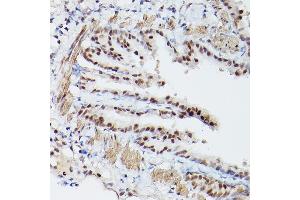 Immunohistochemistry of paraffin-embedded mouse lung using PSME3 Rabbit pAb (ABIN6135015, ABIN6146357, ABIN6146358 and ABIN6216428) at dilution of 1:100 (40x lens). (PSME3 antibody  (C-Term))