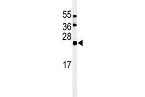 Western blot analysis of ISG15 antibody and HL-60 lysate (ISG15 antibody  (AA 136-165))