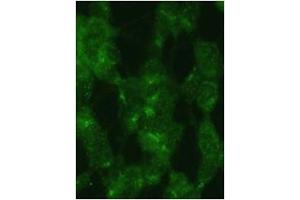 SY5Y cells were pretreated with 5nM bafilomycin for 24hr and fixed in methanol. (MAP1LC3A antibody  (AA 92-121))