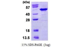 SDS-PAGE (SDS) image for NF-kappa-B inhibitor beta (NFKBIB) (AA 1-356) protein (His tag) (ABIN667688)