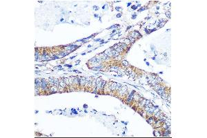 Immunohistochemistry (IHC) image for anti-ATP-Binding Cassette, Sub-Family G (WHITE), Member 1 (ABCG1) (AA 1-220) antibody (ABIN1678514) (ABCG1 antibody  (AA 1-220))