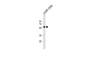 Anti-SLC22A6 Antibody (C-Term) at 1:1000 dilution + CCRF-CEM whole cell lysate Lysates/proteins at 20 μg per lane.
