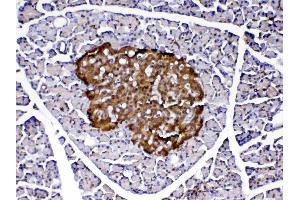 Immunohistochemistry (IHC) image for anti-Parkinson Protein 7 (PARK7) (AA 2-189) antibody (ABIN5519050)