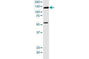 KIF5B monoclonal antibody (M01), clone 2A11. (KIF5B antibody  (AA 864-962))