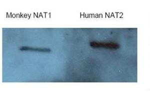 Western Blotting (WB) image for anti-N-Acetyltransferase 2 (Arylamine N-Acetyltransferase) (NAT2) (Middle Region) antibody (ABIN2781757) (NAT2 antibody  (Middle Region))