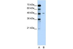 Chromogranin A antibody used at 0. (Chromogranin A antibody)