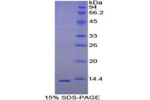 SDS-PAGE (SDS) image for Cystatin C (CST3) (AA 46-147) protein (His tag) (ABIN1877318) (CST3 Protein (AA 46-147) (His tag))