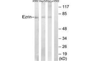 Western blot analysis of extracts from HeLa/HepG2/K562 cells, using Ezrin (Ab-146) Antibody.