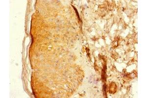 Immunohistochemistry of paraffin-embedded human skin tissue using ABIN7148474 at dilution of 1:100