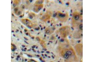 Used in DAB staining on fromalin fixed paraffin-embedded Liver tissue (IFNA2 antibody  (AA 24-188))
