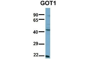 Host:  Rabbit  Target Name:  GOT1  Sample Type:  NCI-H226  Antibody Dilution:  1. (GOT1 antibody  (N-Term))