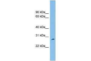 WB Suggested Anti-FAM109A Antibody Titration: 0. (FAM109A antibody  (N-Term))