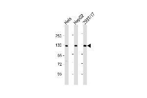 Western Blot at 1:2000 dilution Lane 1: Hela whole cell lysate Lane 2: HepG2 whole cell lysate Lane 3: 293T/17 whole cell lysate Lysates/proteins at 20 ug per lane.