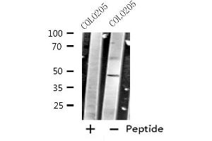 Western blot analysis of extracts from COLO205 cells using CRHR2 antibody. (CRHR2 antibody  (Internal Region))