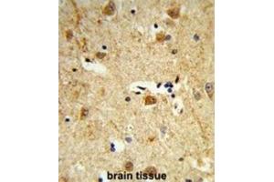 Immunohistochemistry (IHC) image for anti-Dolichol Kinase (DOLK) antibody (ABIN3003934) (Dolichol Kinase antibody)