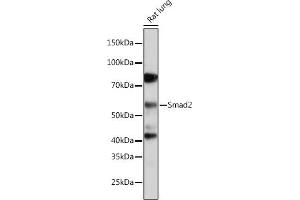 Western blot analysis of extracts of Rat lung, using Smad2 antibody (ABIN7270344) at 1:1000 dilution. (SMAD2 antibody)