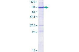 Image no. 1 for Cytotoxic and Regulatory T Cell Molecule (CRTAM) (AA 1-393) protein (GST tag) (ABIN1350400) (CRTAM Protein (AA 1-393) (GST tag))