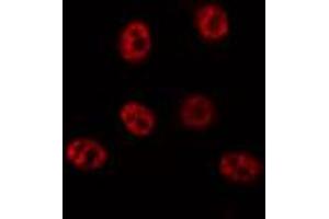 ABIN6272425 staining 293 by IF/ICC. (SCAF1 antibody  (N-Term))