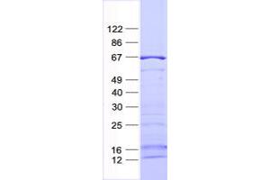Validation with Western Blot