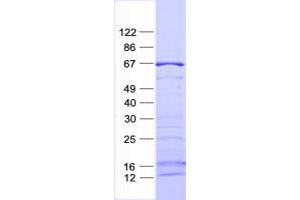 Validation with Western Blot (SGK3 Protein (His tag))
