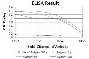Red: Control Antigen (100 ng), Purple: Antigen (10 ng), Green: Antigen (50 ng), Blue: Antigen (100 ng), (RUNX1 antibody)