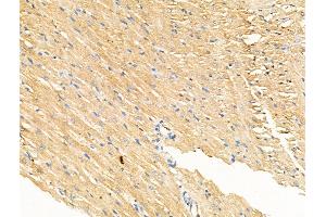 Phospho-IL4R/CD124 (Tyr497) Antibody at 1/100 staining Rat heart tissue by IHC-P.