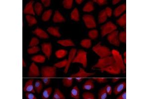 Immunofluorescence analysis of U2OS cells using PSMC4 Polyclonal Antibody (PSMC4 antibody)