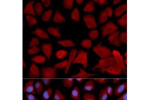 Immunofluorescence analysis of U2OS cells using PSMC4 Polyclonal Antibody (PSMC4 antibody)