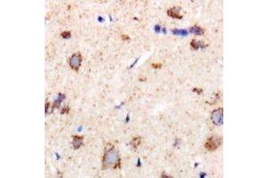 Immunohistochemical analysis of CHMP1B staining in rat brain formalin fixed paraffin embedded tissue section.